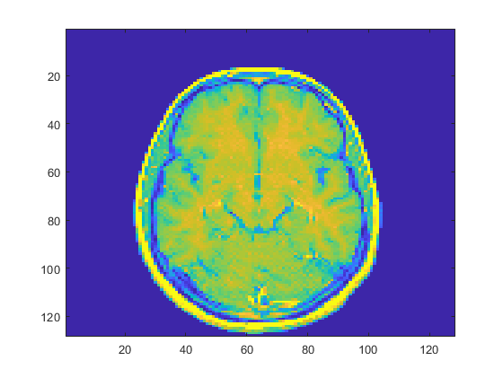 Cross-section of a brain displayed using blue, green, and yellow colors