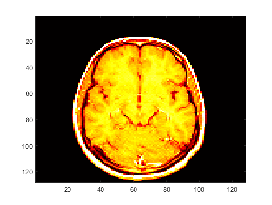 Cross-section of a brain displayed using black, red, and yellow colors