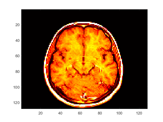 Cross-section of brain displayed using darker red and yellow colors
