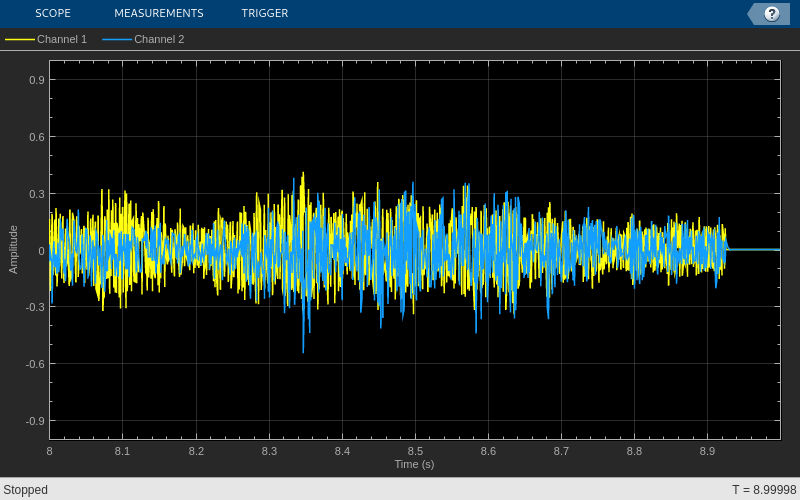 Adaptive Line Enhancer (ALE)