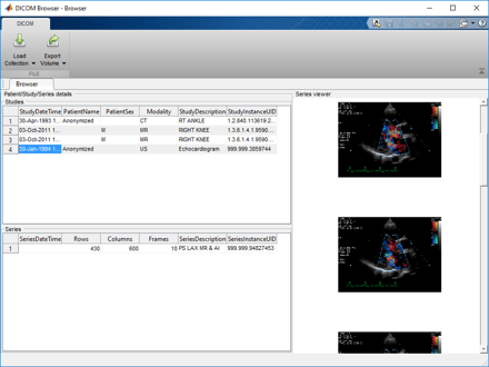 DICOM Browser app