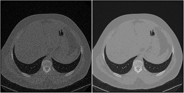 Pair of noisy low-dose and high quality regular-dose CT images of the chest.