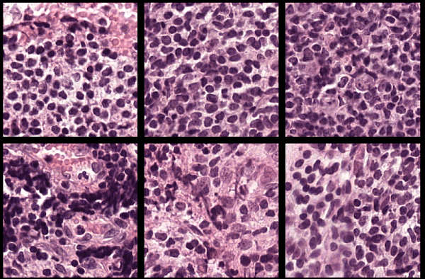 Six patches of normal tissue samples