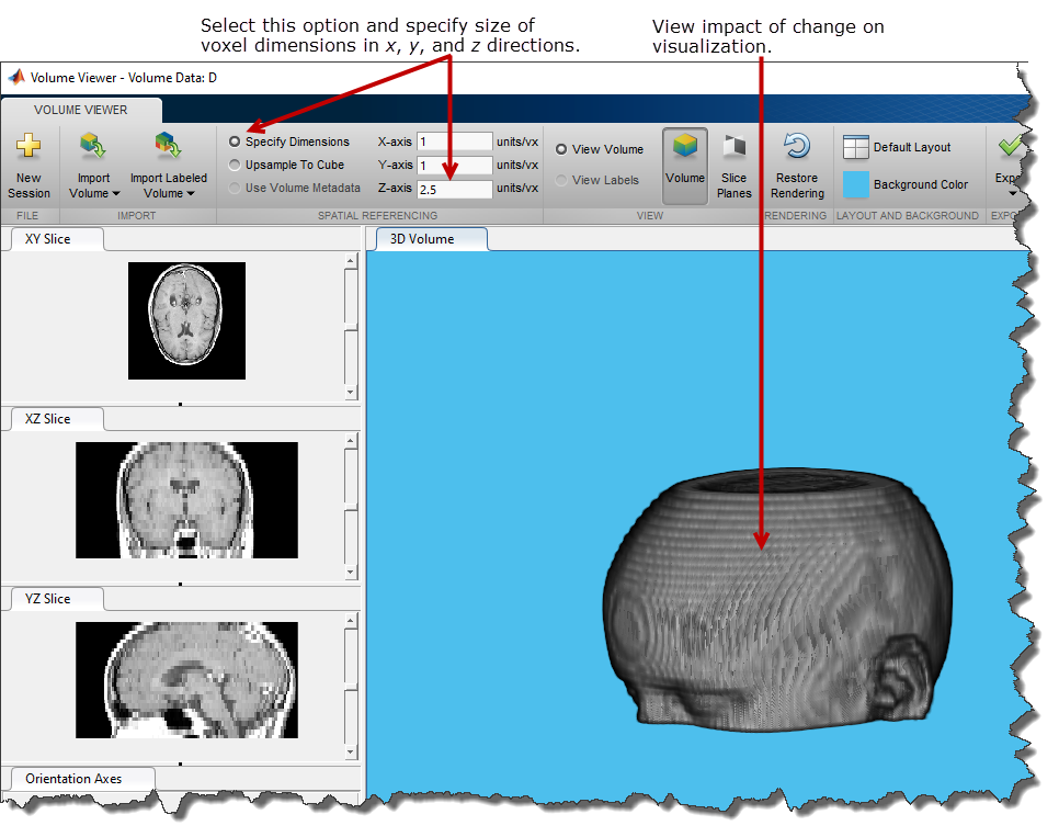 Объемные данные. Volume viewer Matlab. One Volume viewer стоматология. One Volume viewer инструкция на русском. Volume viewer презентация.