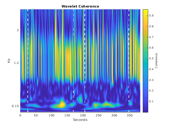 Анализ вейвлета физиологических сигналов