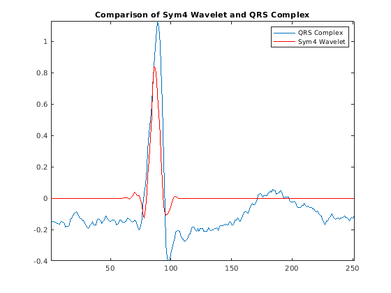 R обнаружение волны в ECG