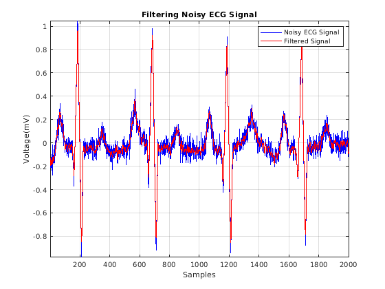 Figure contains an axes object. The axes object with title Filtering Noisy ECG Signal contains 2 objects of type line. These objects represent Noisy ECG Signal, Filtered Signal.