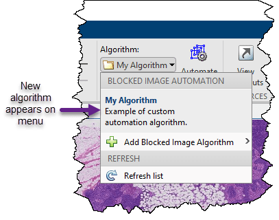 Add new algorithm to Select Algorithm menu.